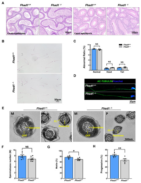 Fhad1−/−mice had reduced sperm motility.