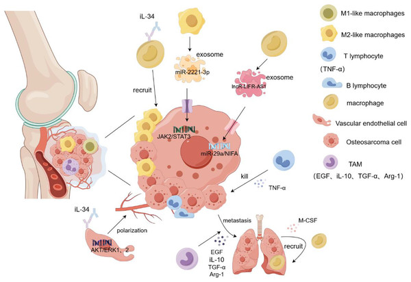 Role of macrophages in osteosarcoma cell proliferation and metastasis.