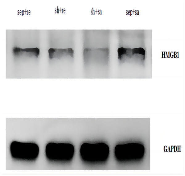 Expression of HMGB1 protein in lung tissue of each group.