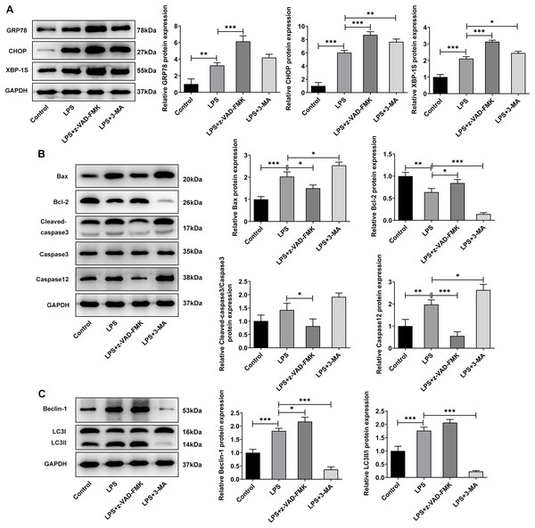 The effect of apoptosis inhibitor and autophagy inhibitor on ERS-, apoptosis- and autophagy-related proteins.