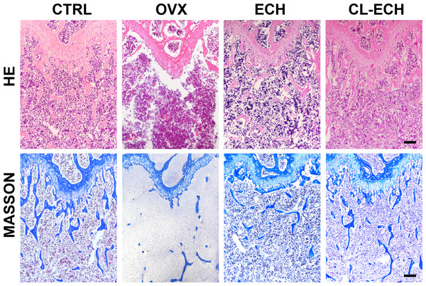 HE and Masson staining of sectioned bone tissues of the mice in the groups. Scale bar: 100 µm.