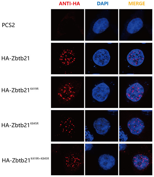 SUMOylation of Zbtb21 is irrelevant to its subcellular localization.