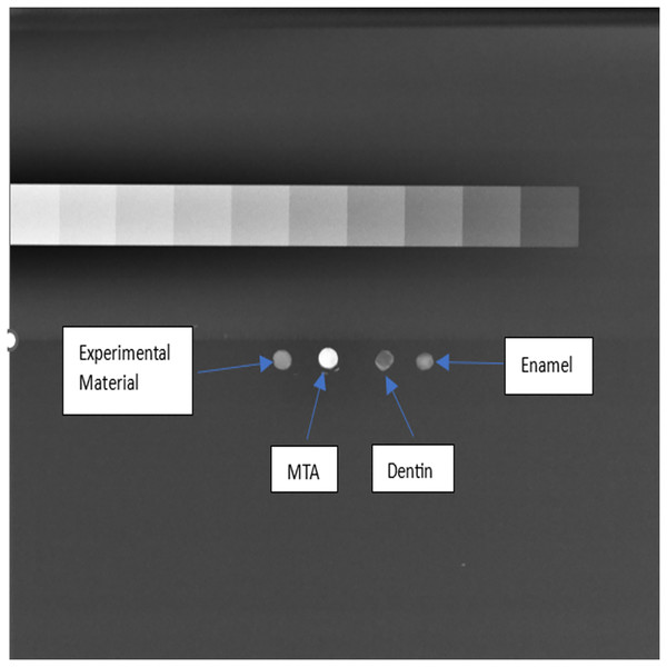 Analysis of radiopacity using Image J software.