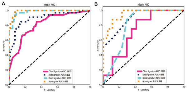 The ROC curves of the clinical model, radiomics model, deep learning model and combined model in the training cohort (A) and the validation cohort (B).