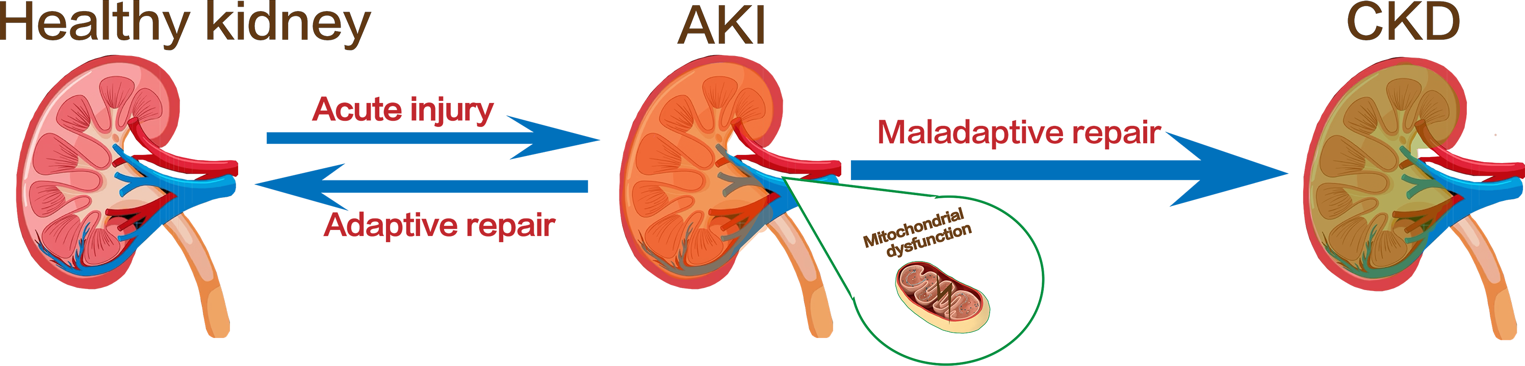 The role of mitophagy in the development of chronic kidney disease [PeerJ]