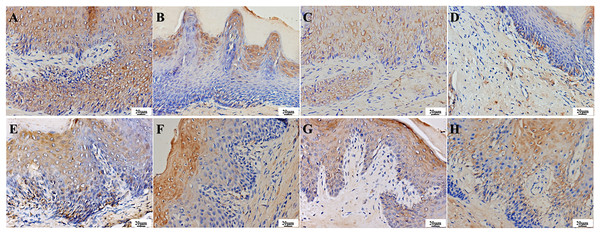 Expression of IL-17 in the palate mucosa of each group after treatment.