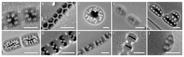 (A–J) Pore occlusions in several genera of diatoms.