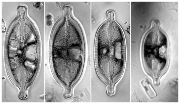 (A–D) Placoneis elinae sp. nov. (Fresh) Sample no. B445 (corresponds material in the slide no. 13899).