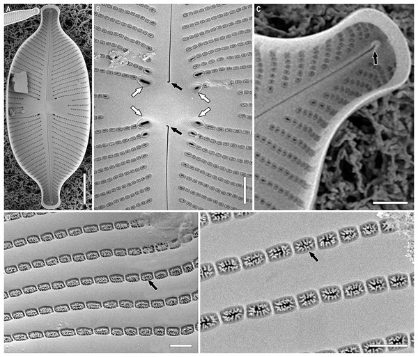 (A–E) Placoneis elinae sp. nov. Sample 13899 (corresponds material in the slide no. 13899).