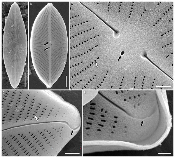 (A–E) Chudaevia densistriata sp. nov. Sample 02168 (corresponds material in the slide no. 02168).