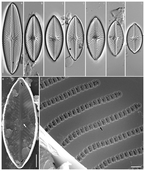 (A–I) Chudaevia flabellata comb. nov. Slides no. 00955 (A, D, E–I), 00996 (B, C).