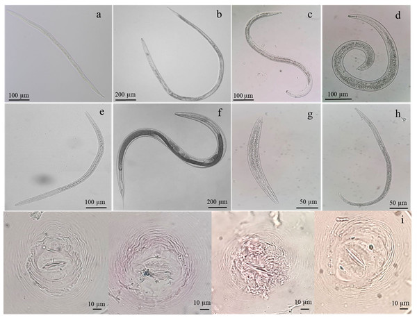 Identification of nematodes obtained from roots and rhizosphere soils of Oryza sativa L. cv. Khao Dawk Mali 105 based on morphology.