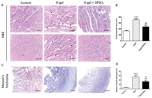 Transplanted DPSCs improved the cardiac histopathological alterations and cardiac fibrosis in D-gal-induced ageing rats at 2 weeks post-transplantation of the last DPSC injection.