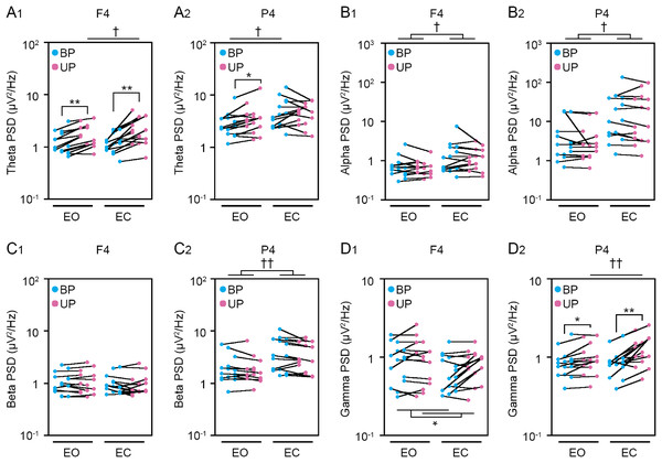 Change in standing patterns affected the power spectral densities of electroencephalograms.