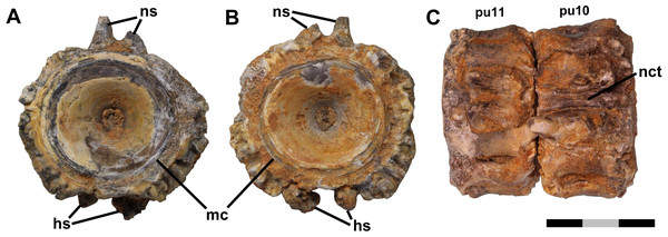 Free vertebrae.