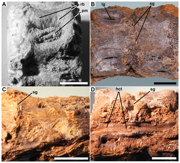 Details of pathology.