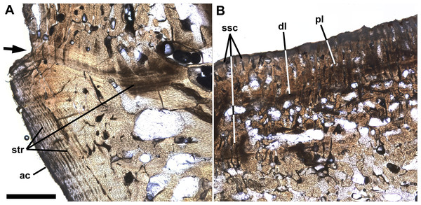 Growth lines and palisade-like layer.