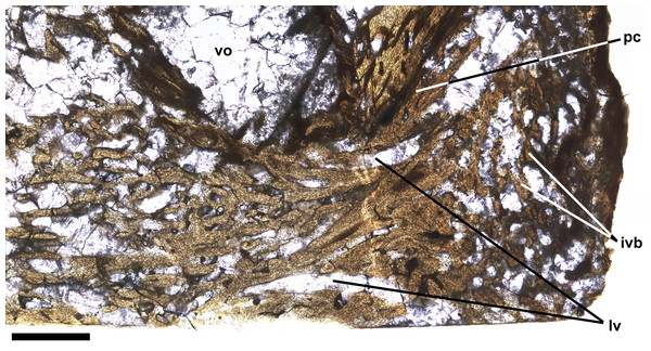 Intervertebral bone.