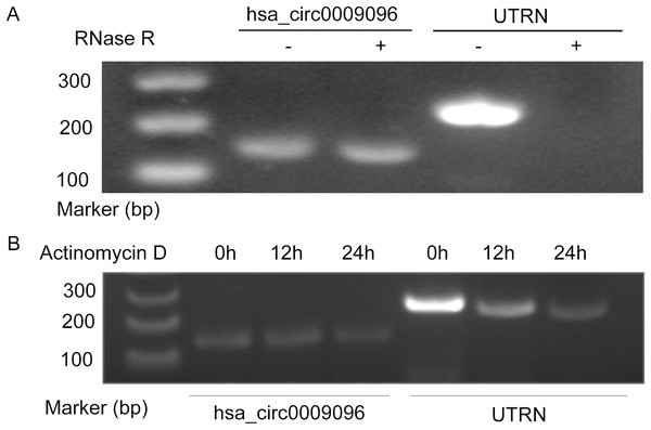 Hsa_circ_0009096 was resistant to RNase R and actinomycin D treatment.
