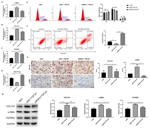 Hsa_circ_0009096 silencing suppressed TGF-β1-induced HSC proliferation and fibrosis.