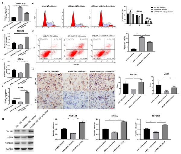 MiR-370-3p mediated hsa_circ_0009096-regulated proliferation and fibrosis of TGF-β1-treated HSCs.