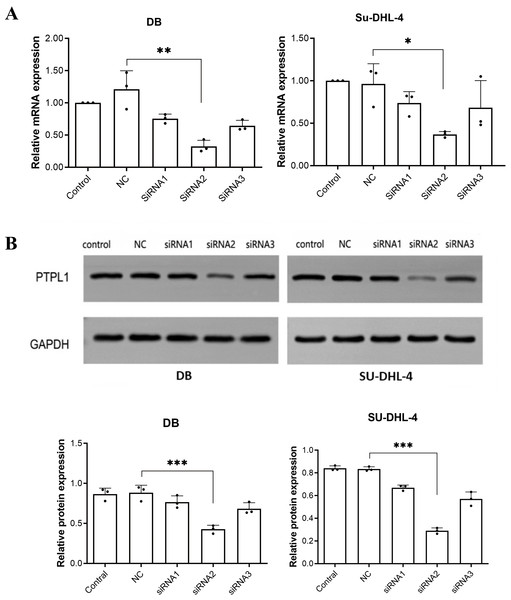 Knockdown efficiencies of three siRNAs verified using RT-PCR and Western blotting.