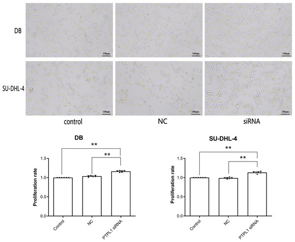 Cell proliferation and proliferation rate of control group, NC group and siRNA group in DB and SU-DHL-4 cell lines.