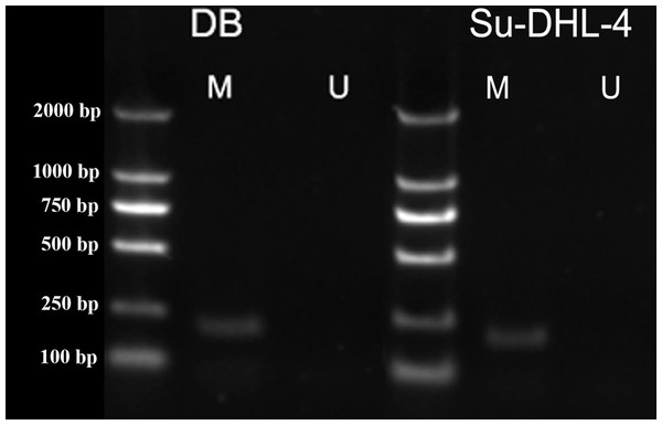 PTPL1 methylation in DB and SU-DHL-4 cell lines detected by MSPCR.
