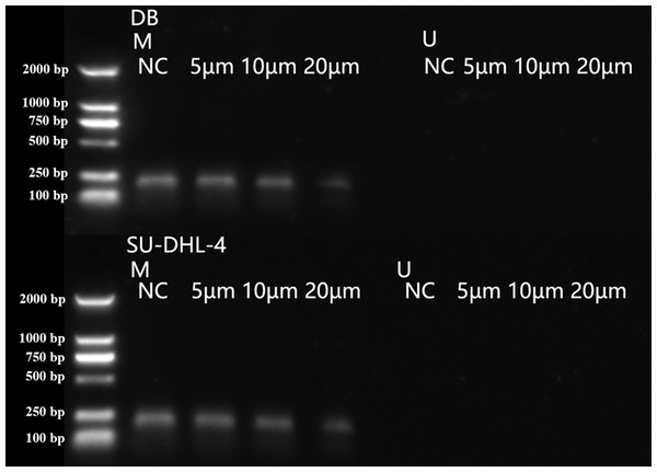 PTPL1 methylation in DB and SU-DHL-4 cells treated with different doses of arsenic disulfide detected by MSPCR.