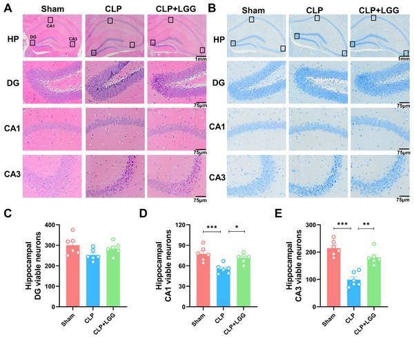 Pathological changes in the hippocampal region of mice with sepsis supplemented with LGG.