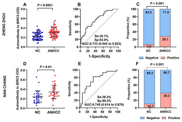 Multi-center validation of anti-BIRC5 autoantibodies.