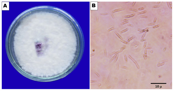 (A) Pure culture of F. oxysporum. (B) Macro and microcondia (40 X).