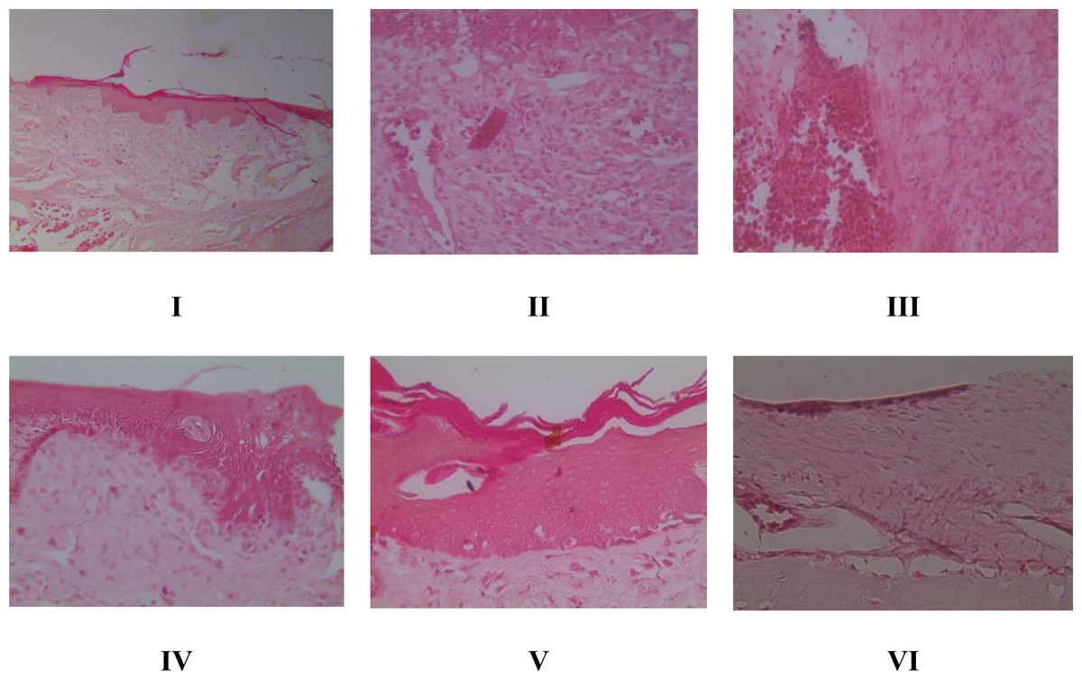 Brazilin cream from Caesalpinia sappan inhibit periodontal disease: in vivo  study [PeerJ]