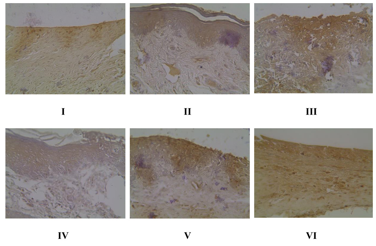 Brazilin cream from Caesalpinia sappan inhibit periodontal disease: in vivo  study [PeerJ]