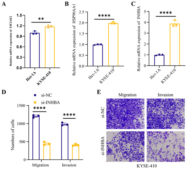 Hub genes mediated the metastasis of ESCC cells.