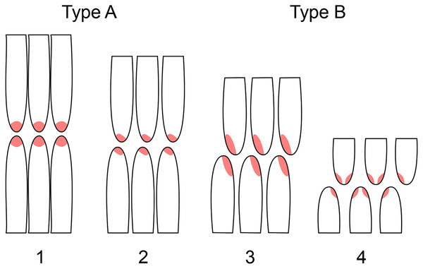 Schematic representation of the two wear types and four subtypes of sauropod dentitions.