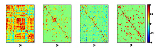 The adjacency matrices of the same subject estimated by four different methods, i.e., (A) PC, (B) PCSparsity, (C) SR, and (D) K-PC.