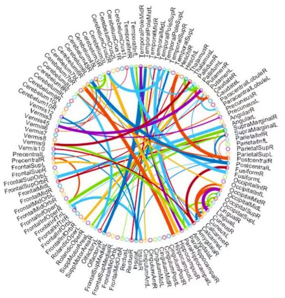 The most discriminative features (network connections) involved in the classification tasks by using a t-test with p < 0.005.