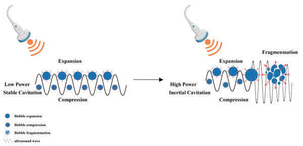 Cavitation induced by LIFU.