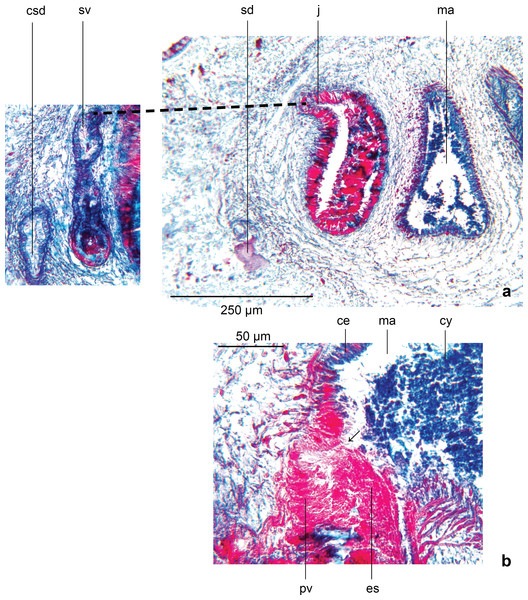 Amaga pseudobama n. sp., male organs, histology.