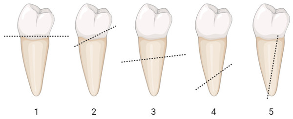 Schematic illustration of the failure mode classification.