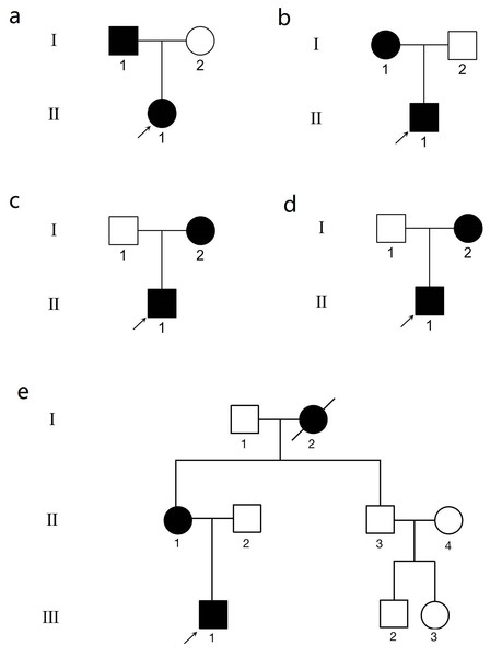 The genogram of five Chinese family with keratoconus (KC).