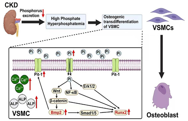 The mechanism of vascular calcification involving BMP2 and RUNX2.