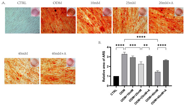 The effect of high glucose and ANXA2 on osteoblastic differentiation of PDLCs.