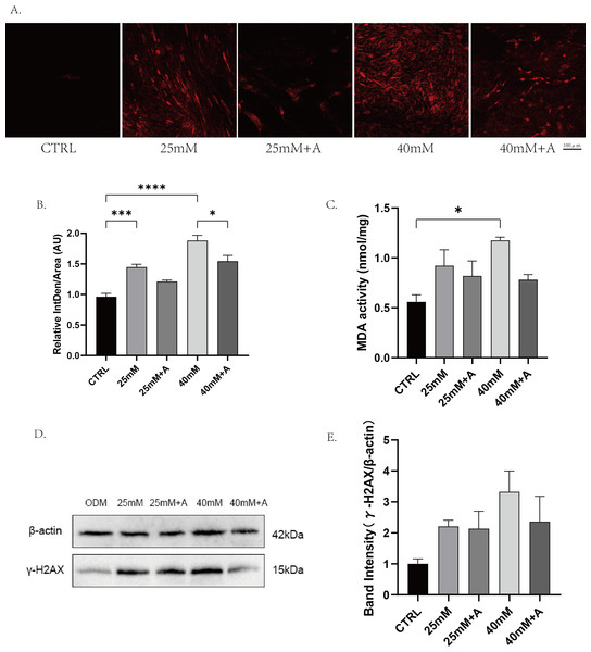 The effect of high glucose on oxidative stress of PDLCs in ODM.