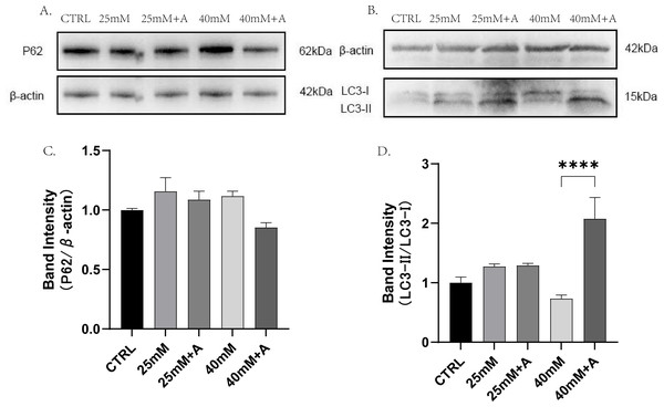 The effect of high glucose and ANXA2 on autophagy of PDLCs.