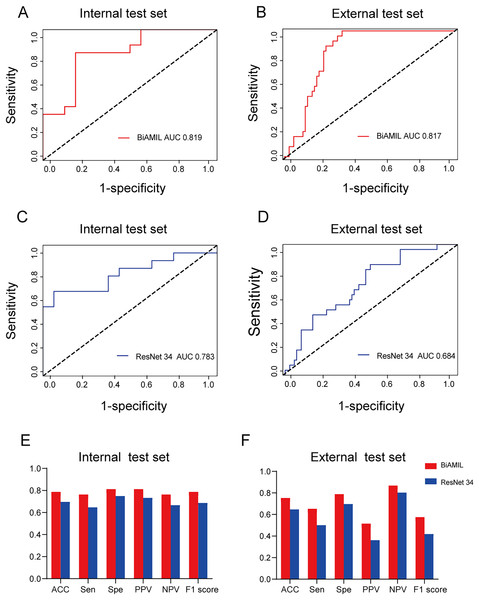 Predictive performance of the BiAMIL and ResNet34 models.