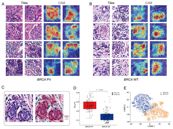 Visualization of important regions in H&E images for predicting BRCA status.