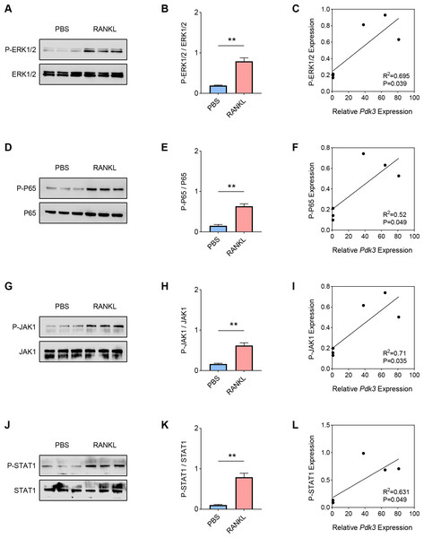 Positive correlation between Pdk3 and relevant signaling pathways in RANKL-induced osteoclastogenesis in vitro.