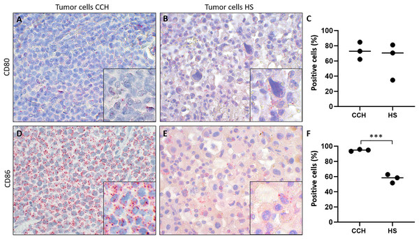 Comparison of mRNA expression of co-stimulatory B7 family ligands CD80 and CD86 in canine cutaneous histiocytoma (CCH) compared to canine histiocytic sarcoma (HS).